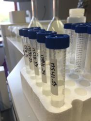 Digested samples from Staten Island marshes to be analyzed for trace metals